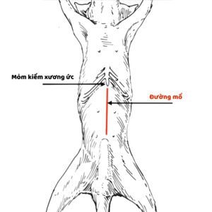 Đường mổ giữa bụng
