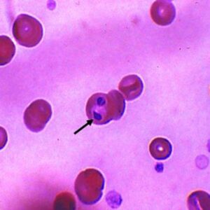 Babesia - Hồng cầu